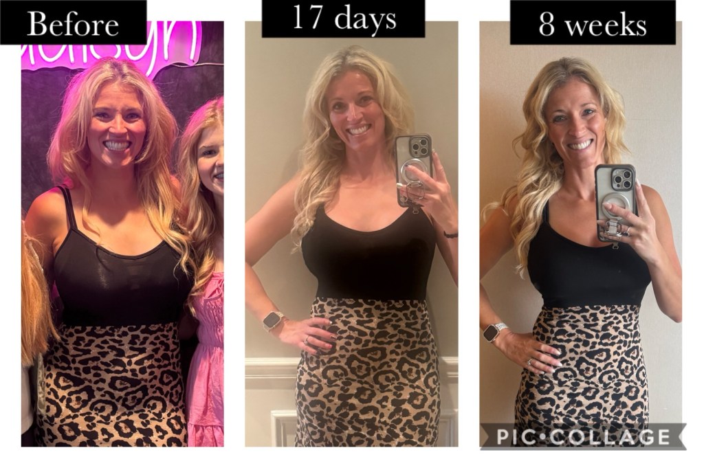 Benefits of Microdosing GLP-1 Peptides