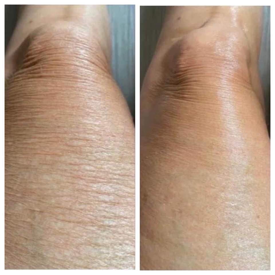 What is the Renu Spa and how does it&nbsp;work?